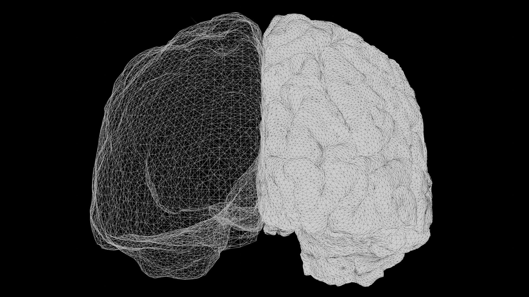 Neuroplasticidad y LCA